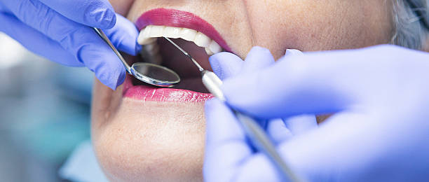 Best Emergency Dental Extractions in Amery, WI