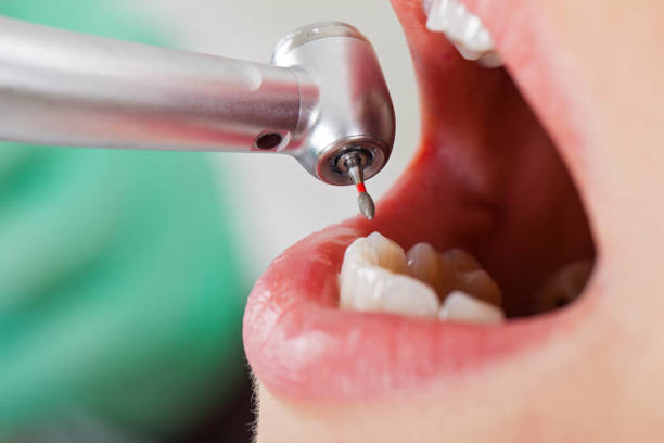 Best Pediatric Emergency Dentist in Amery, WI